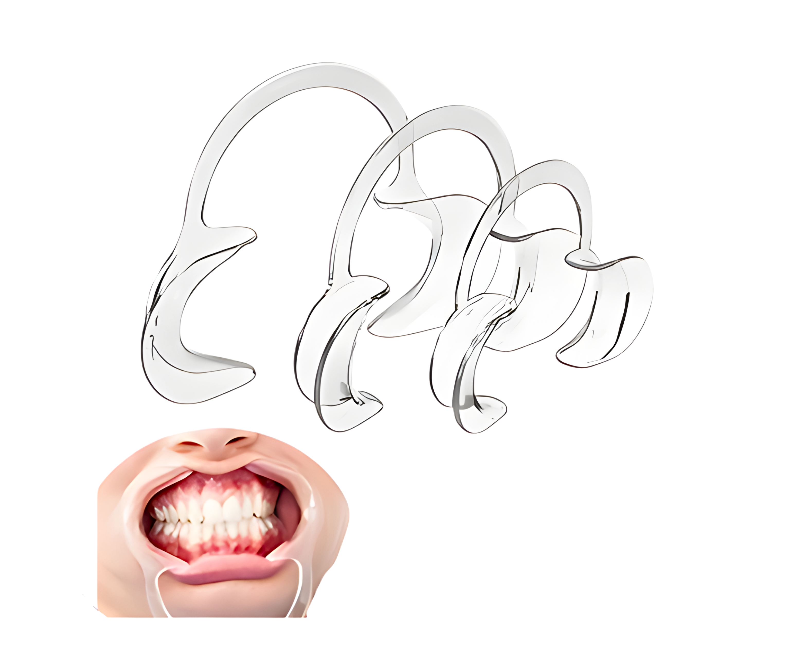 ECARTEUR LARGE TRANSPARENT 2PCS